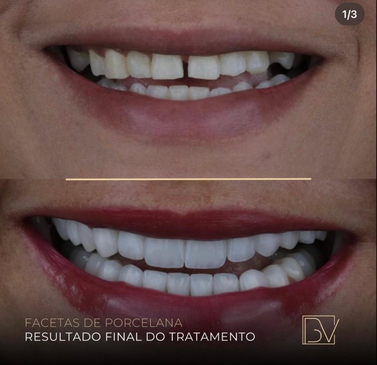 Slider image (6) Clinic Bel Viso